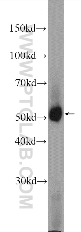 Western Blot (WB) analysis of mouse liver tissue using PDK1 Polyclonal antibody (10026-1-AP)