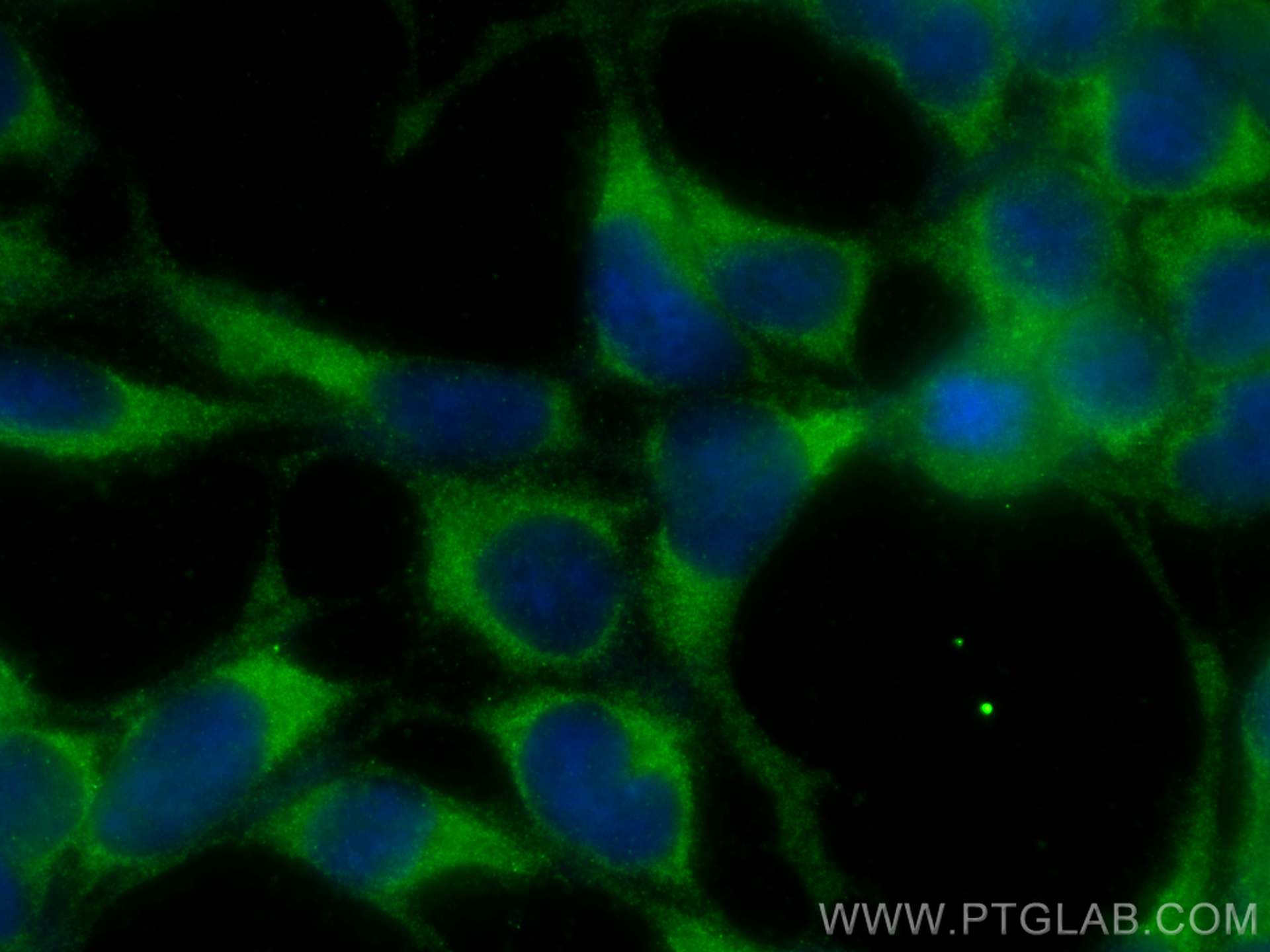 Immunofluorescence (IF) / fluorescent staining of HEK-293 cells using PDK1 Polyclonal antibody (18262-1-AP)