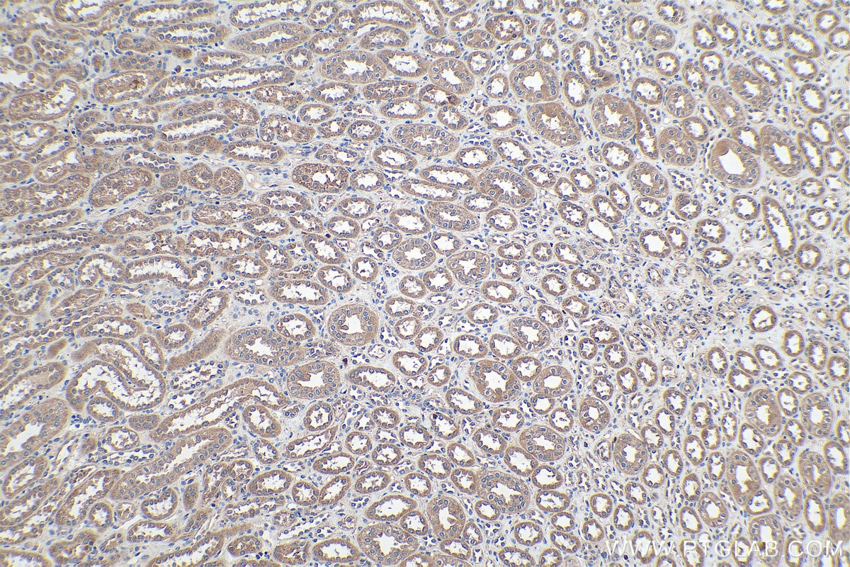 Immunohistochemistry (IHC) staining of human kidney tissue using PDK1 Polyclonal antibody (18262-1-AP)