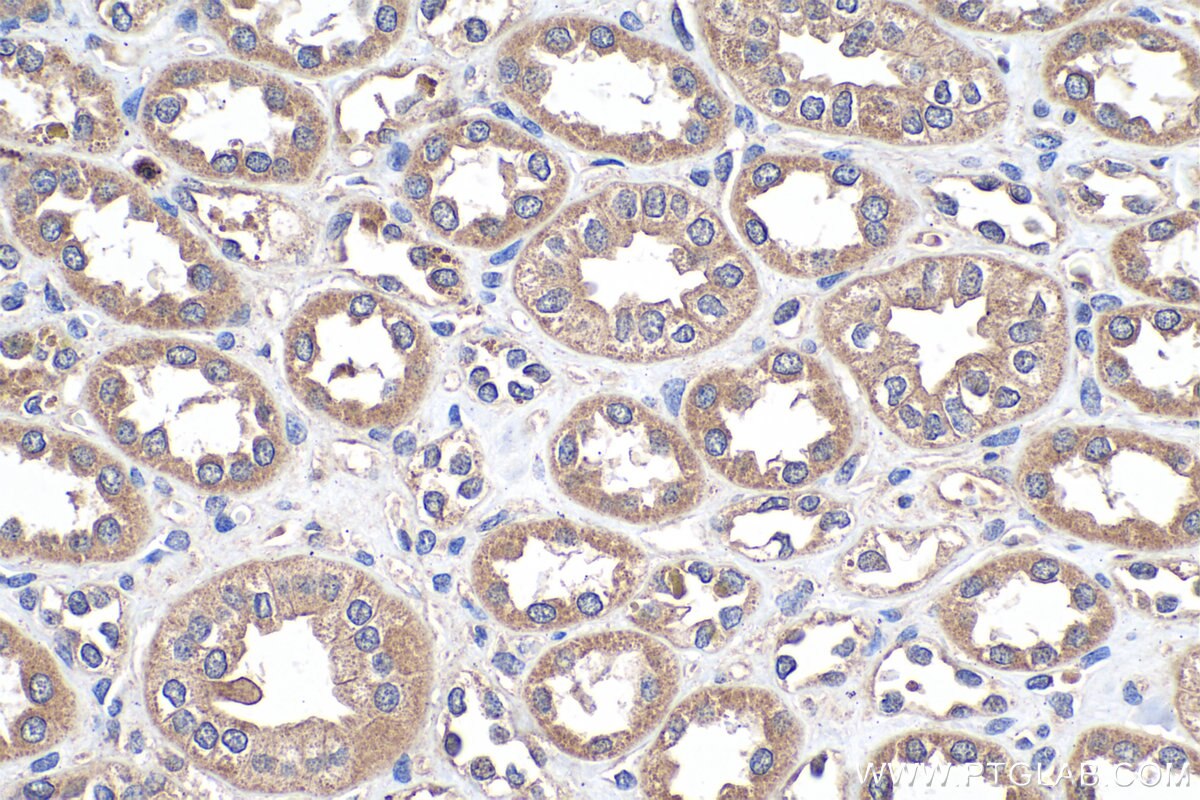 IHC staining of human kidney using 18262-1-AP