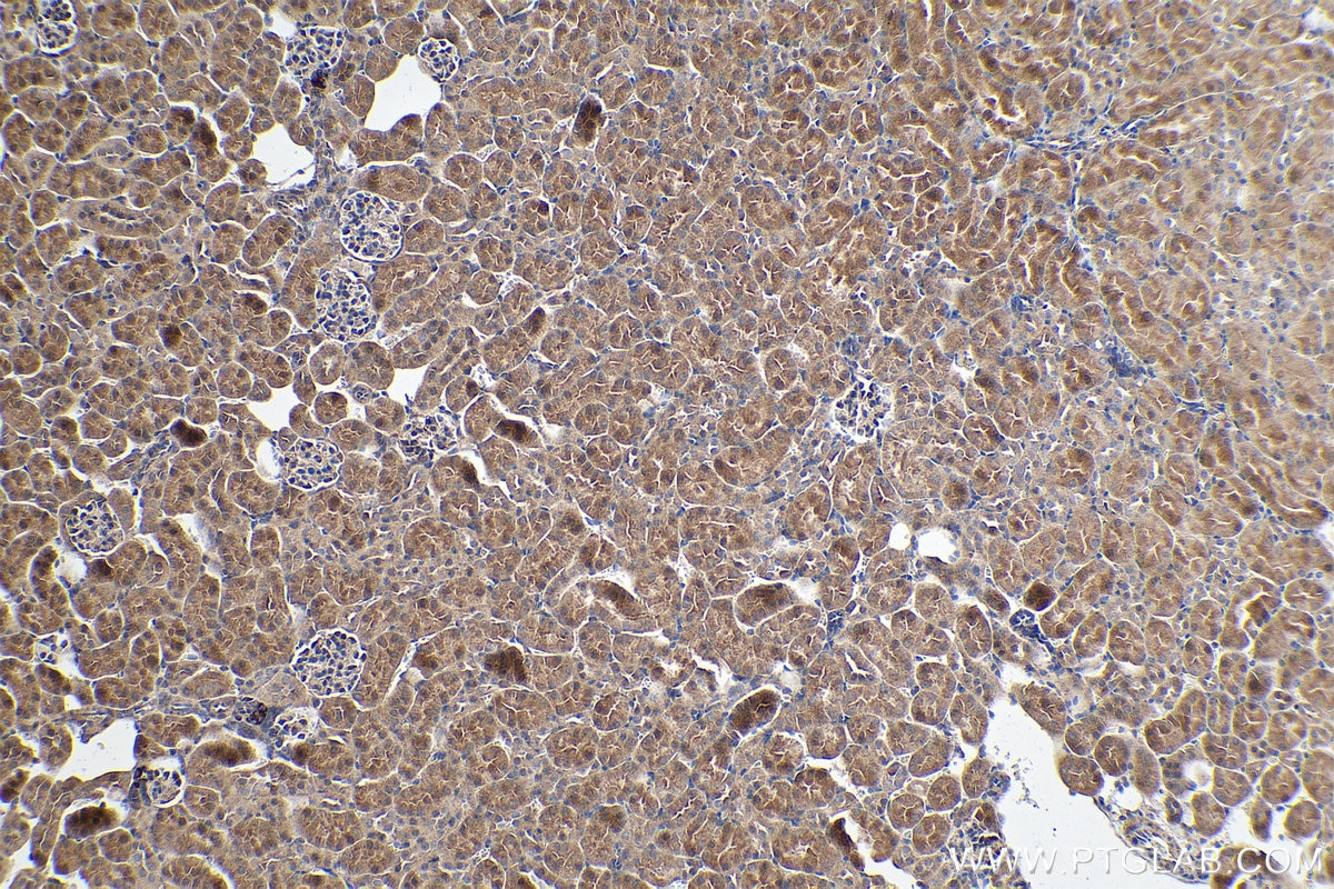 Immunohistochemistry (IHC) staining of mouse kidney tissue using PDK1 Polyclonal antibody (18262-1-AP)
