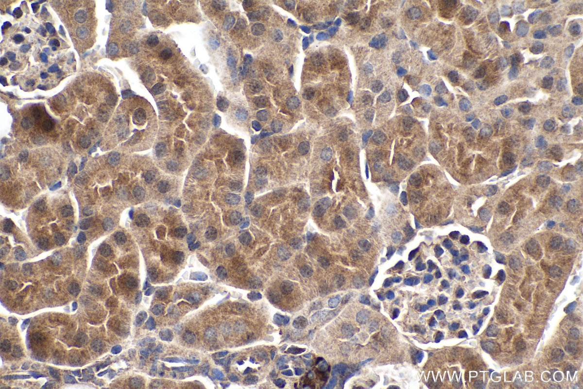Immunohistochemistry (IHC) staining of mouse kidney tissue using PDK1 Polyclonal antibody (18262-1-AP)