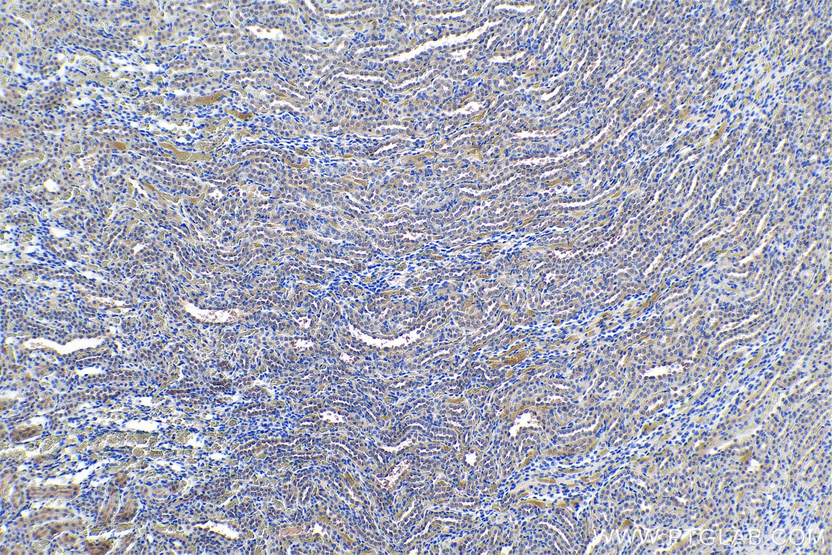 IHC staining of rat kidney using 18262-1-AP