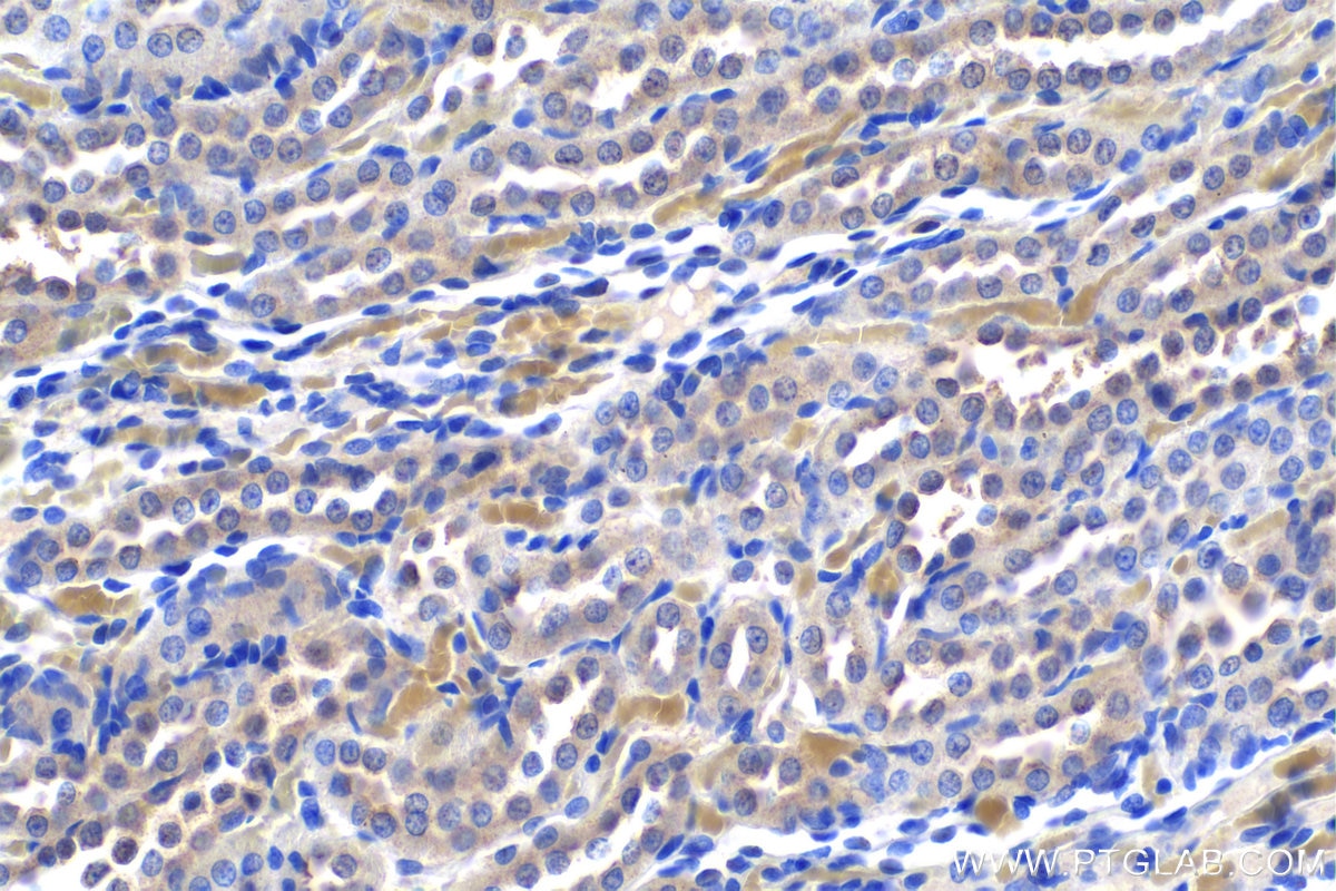 IHC staining of rat kidney using 18262-1-AP