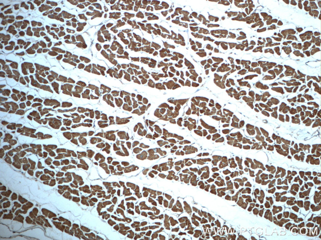 IHC staining of human heart using 18262-1-AP