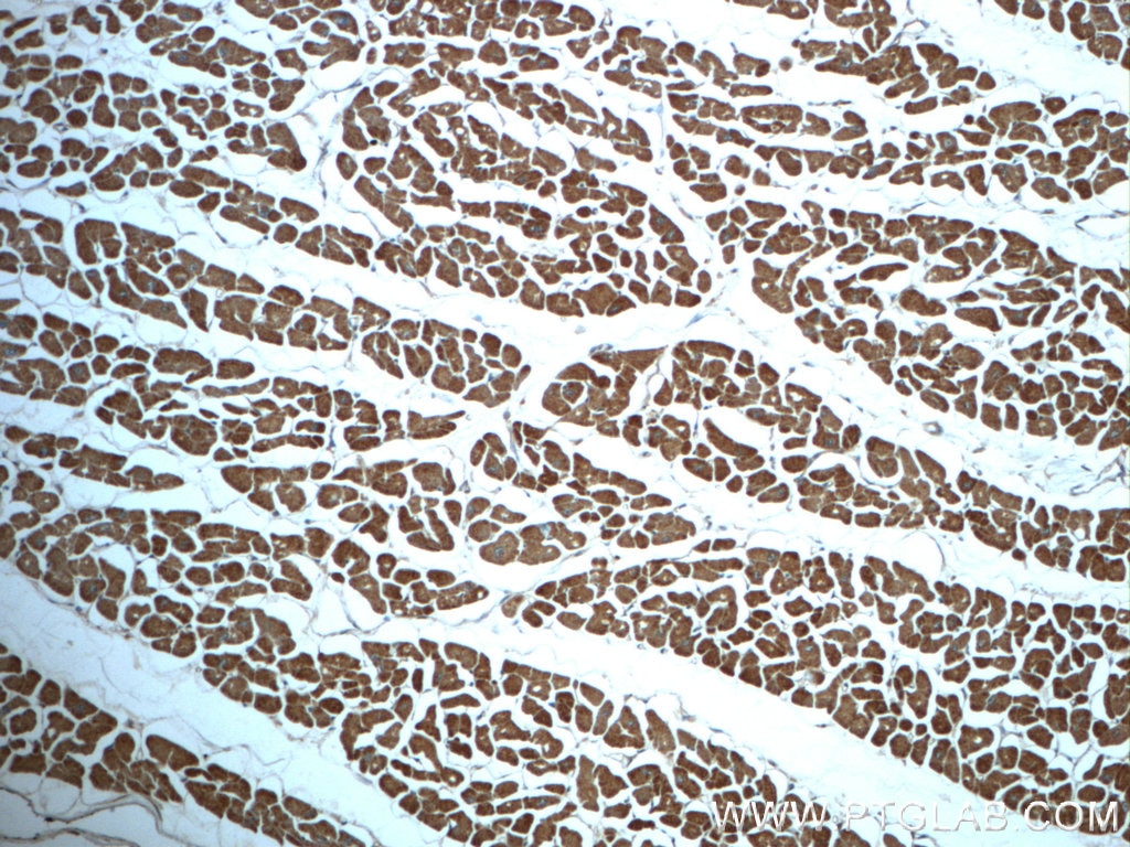 Immunohistochemistry (IHC) staining of human heart tissue using PDK1 Polyclonal antibody (18262-1-AP)