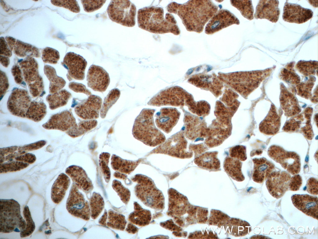 IHC staining of human heart using 18262-1-AP