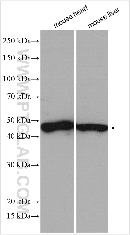 Western Blot (WB) analysis of various lysates using PDK1 Polyclonal antibody (18262-1-AP)