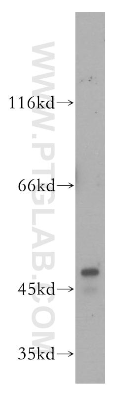PDK1 Polyclonal antibody