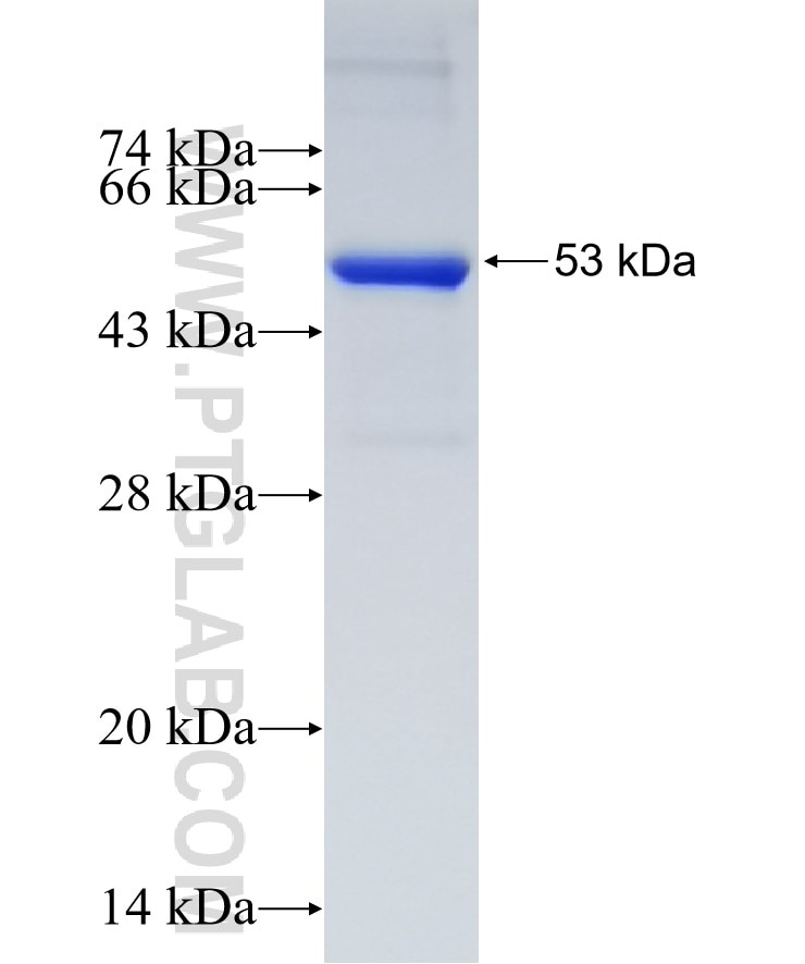 PDK1 fusion protein Ag23160 SDS-PAGE