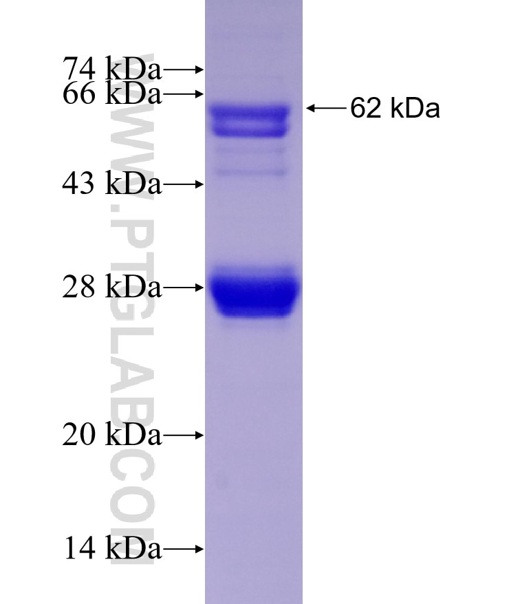 PDK1 fusion protein Ag0025 SDS-PAGE