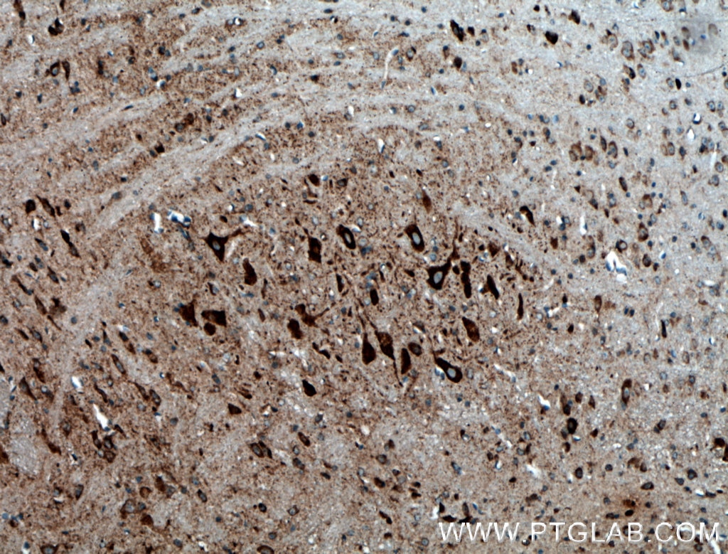 Immunohistochemistry (IHC) staining of mouse brain tissue using PDK2 Polyclonal antibody (15647-1-AP)