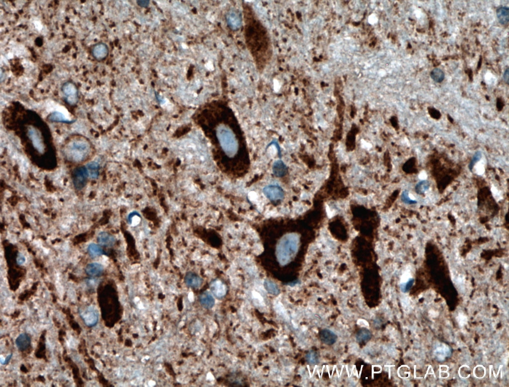 Immunohistochemistry (IHC) staining of mouse brain tissue using PDK2 Polyclonal antibody (15647-1-AP)