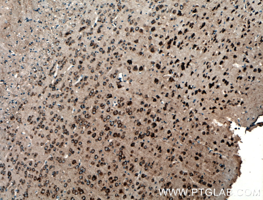 Immunohistochemistry (IHC) staining of mouse brain tissue using PDK2 Polyclonal antibody (15647-1-AP)