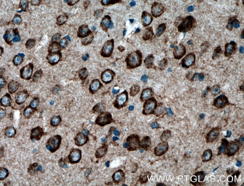 IHC staining of mouse brain using 15647-1-AP