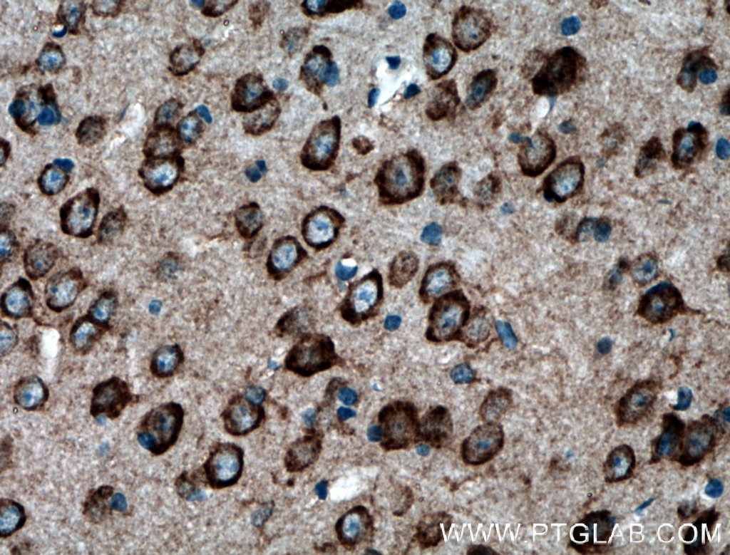 Immunohistochemistry (IHC) staining of mouse brain tissue using PDK2 Polyclonal antibody (15647-1-AP)