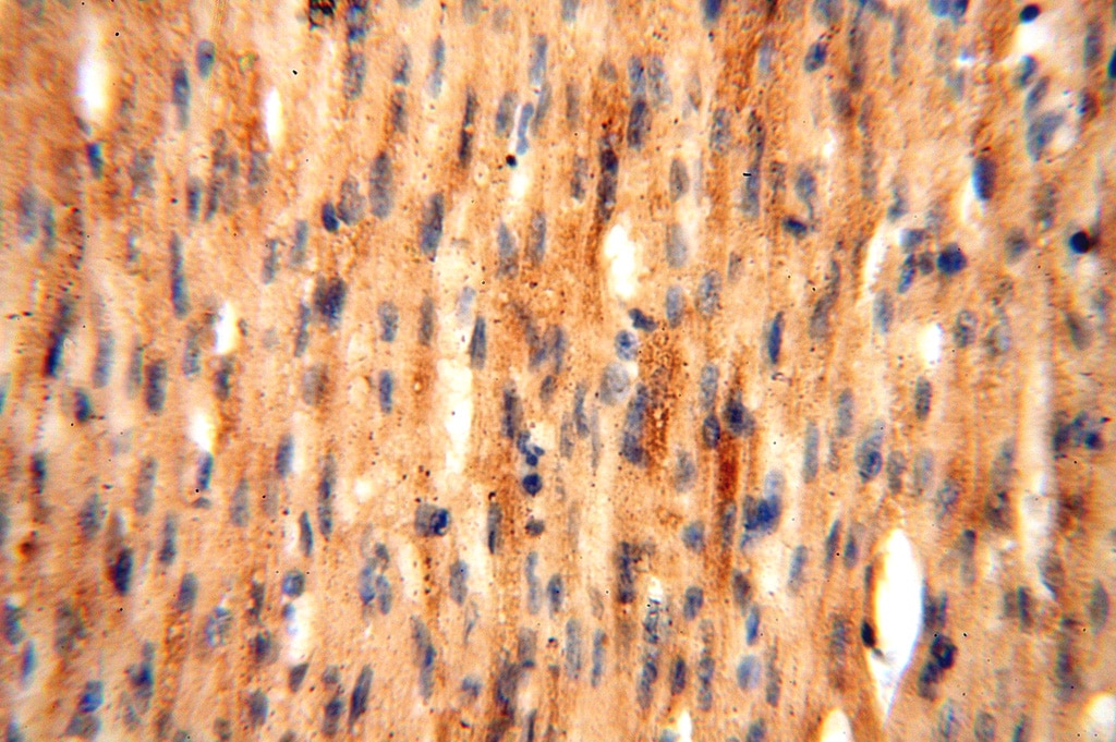 IHC staining of human heart using 15647-1-AP