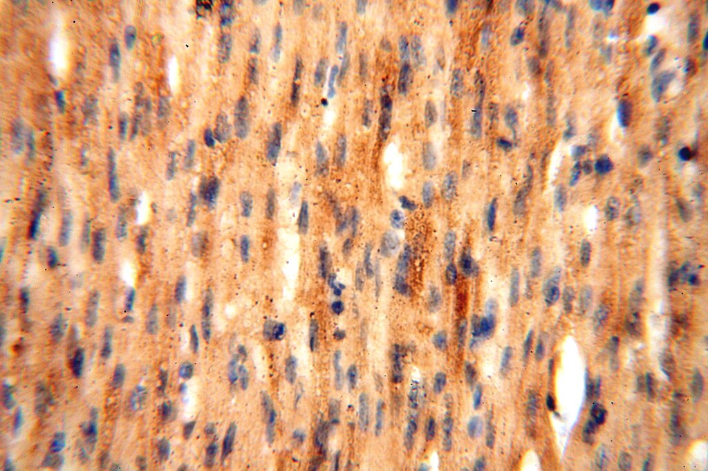 Immunohistochemistry (IHC) staining of human heart tissue using PDK2 Polyclonal antibody (15647-1-AP)