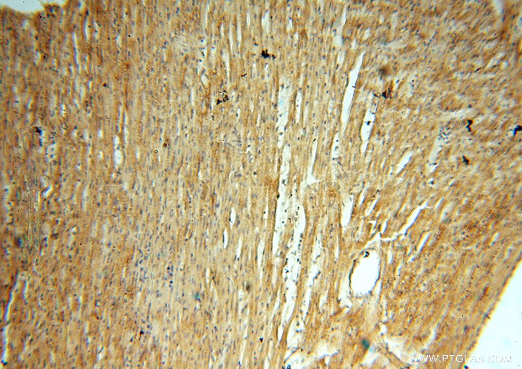 Immunohistochemistry (IHC) staining of human heart tissue using PDK2 Polyclonal antibody (15647-1-AP)