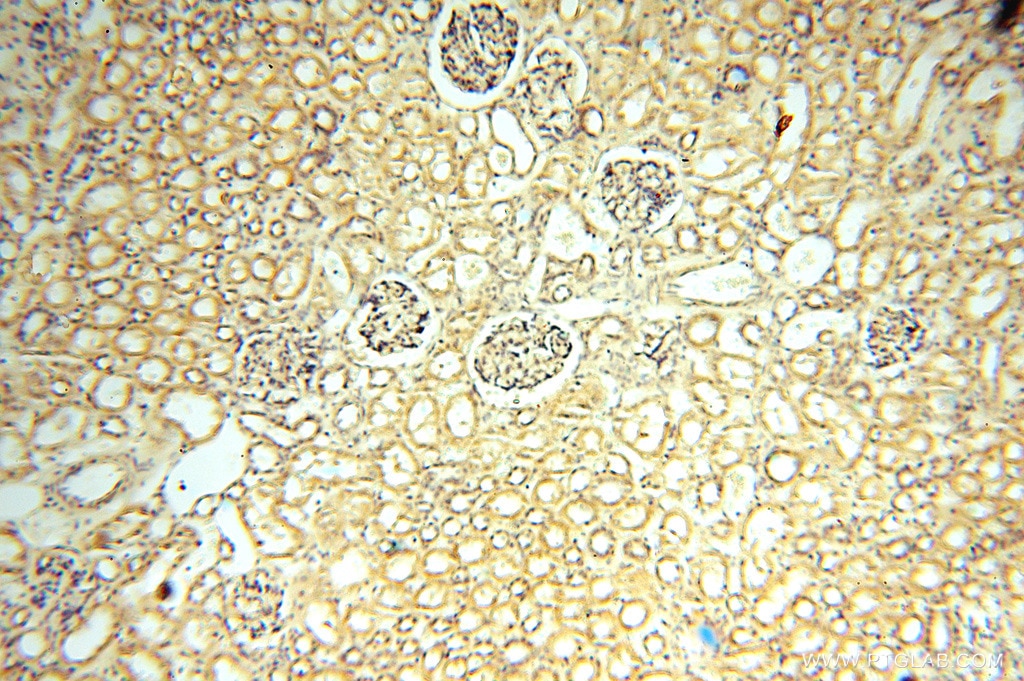 IHC staining of human kidney using 15647-1-AP