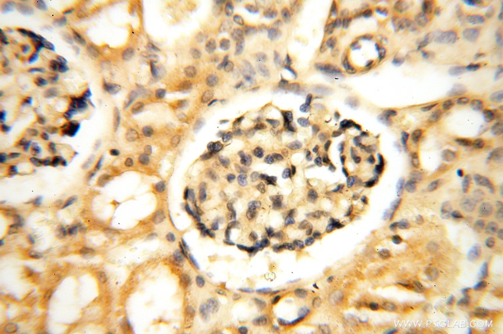 Immunohistochemistry (IHC) staining of human kidney tissue using PDK2 Polyclonal antibody (15647-1-AP)