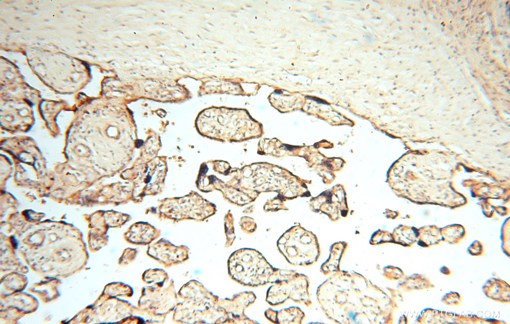 Immunohistochemistry (IHC) staining of human placenta tissue using PDK2 Polyclonal antibody (15647-1-AP)