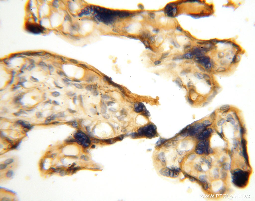 Immunohistochemistry (IHC) staining of human placenta tissue using PDK2 Polyclonal antibody (15647-1-AP)