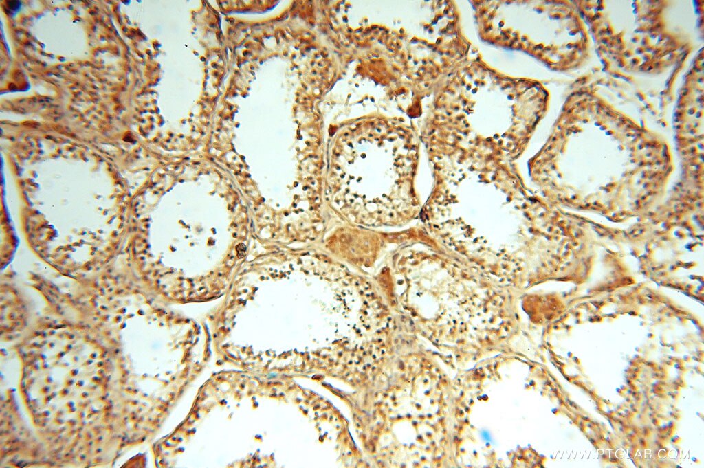 Immunohistochemistry (IHC) staining of human testis tissue using PDK2 Polyclonal antibody (15647-1-AP)