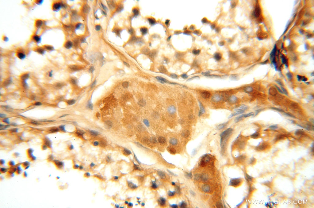 Immunohistochemistry (IHC) staining of human testis tissue using PDK2 Polyclonal antibody (15647-1-AP)