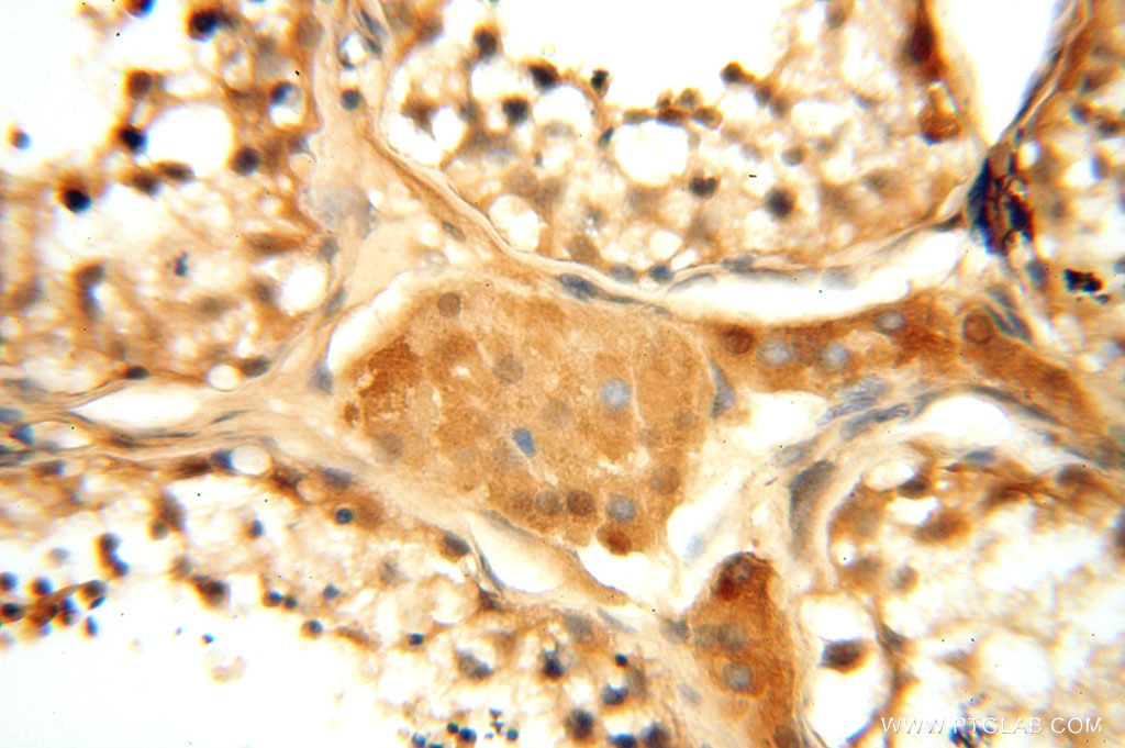 IHC staining of human testis using 15647-1-AP