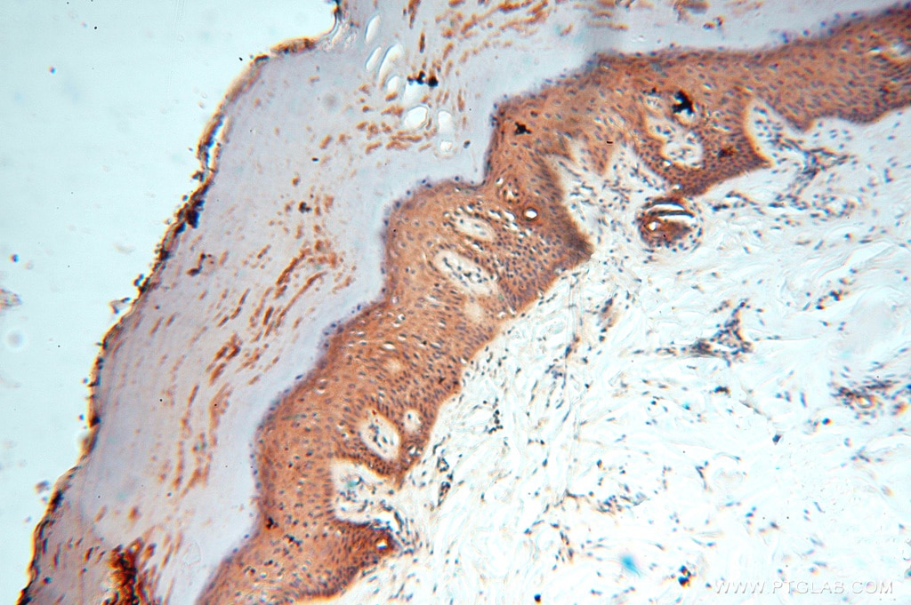 IHC staining of human skin using 15647-1-AP