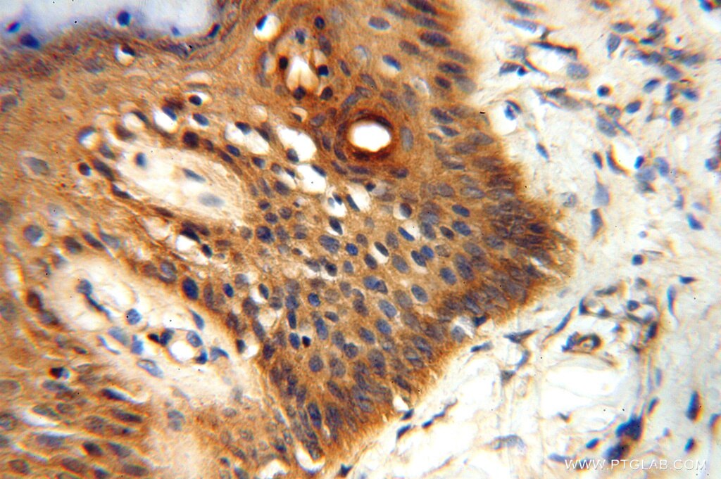 Immunohistochemistry (IHC) staining of human skin tissue using PDK2 Polyclonal antibody (15647-1-AP)