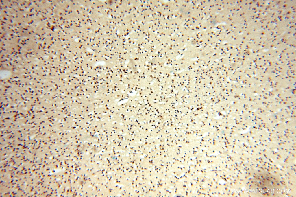 Immunohistochemistry (IHC) staining of human brain tissue using PDK2 Polyclonal antibody (15647-1-AP)
