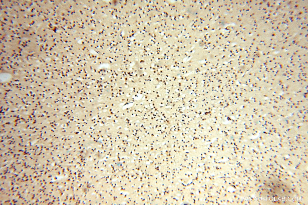 IHC staining of human brain using 15647-1-AP