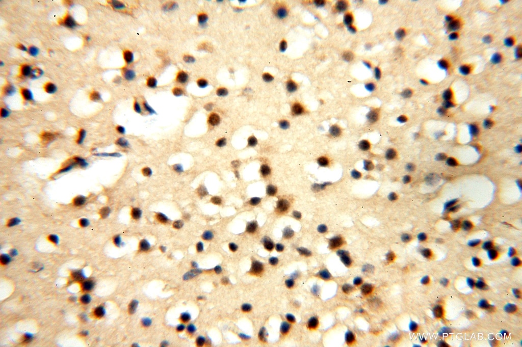 Immunohistochemistry (IHC) staining of human brain tissue using PDK2 Polyclonal antibody (15647-1-AP)