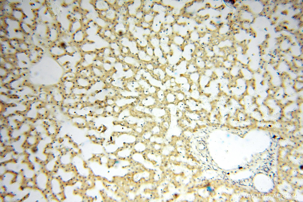 Immunohistochemistry (IHC) staining of human liver tissue using PDK2 Polyclonal antibody (15647-1-AP)