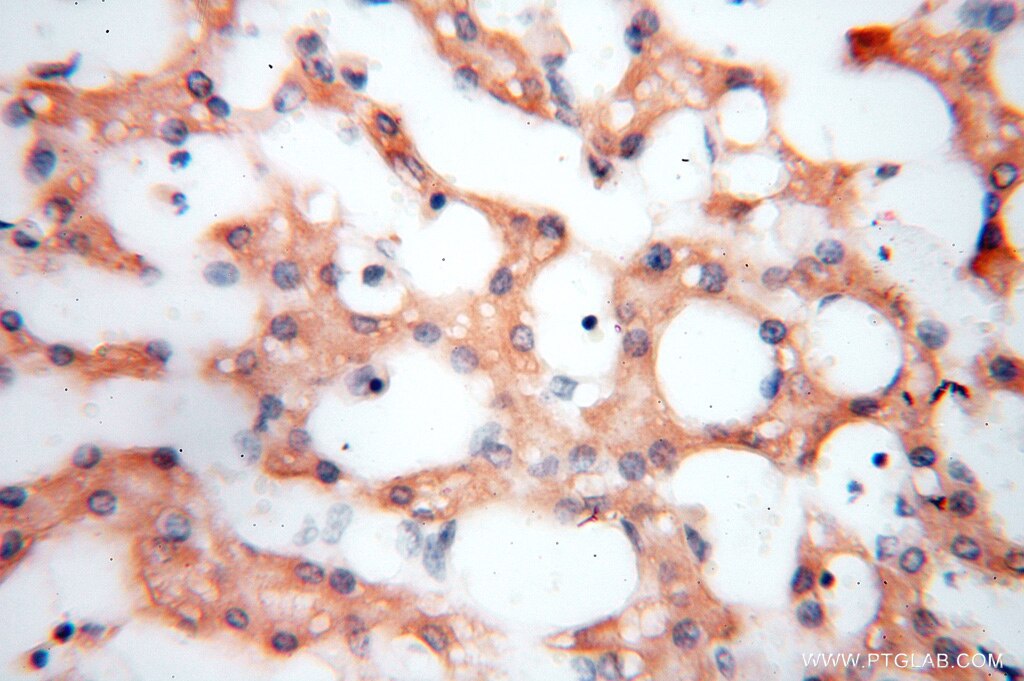 Immunohistochemistry (IHC) staining of human liver tissue using PDK2 Polyclonal antibody (15647-1-AP)