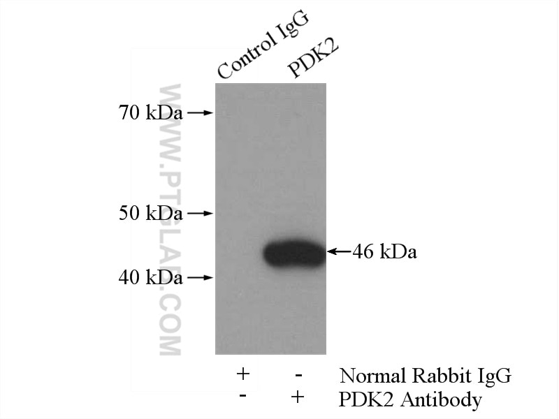 Immunoprecipitation (IP) experiment of mouse skeletal muscle tissue using PDK2 Polyclonal antibody (15647-1-AP)