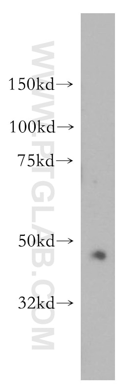 Western Blot (WB) analysis of HeLa cells using PDK2 Polyclonal antibody (15647-1-AP)