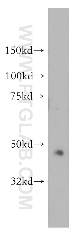 WB analysis of HeLa using 15647-1-AP