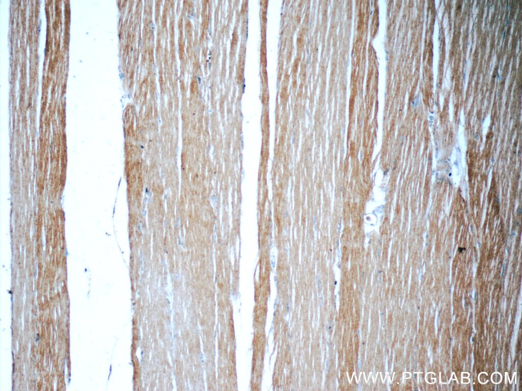 Immunohistochemistry (IHC) staining of human skeletal muscle tissue using PDK3 Polyclonal antibody (12215-1-AP)