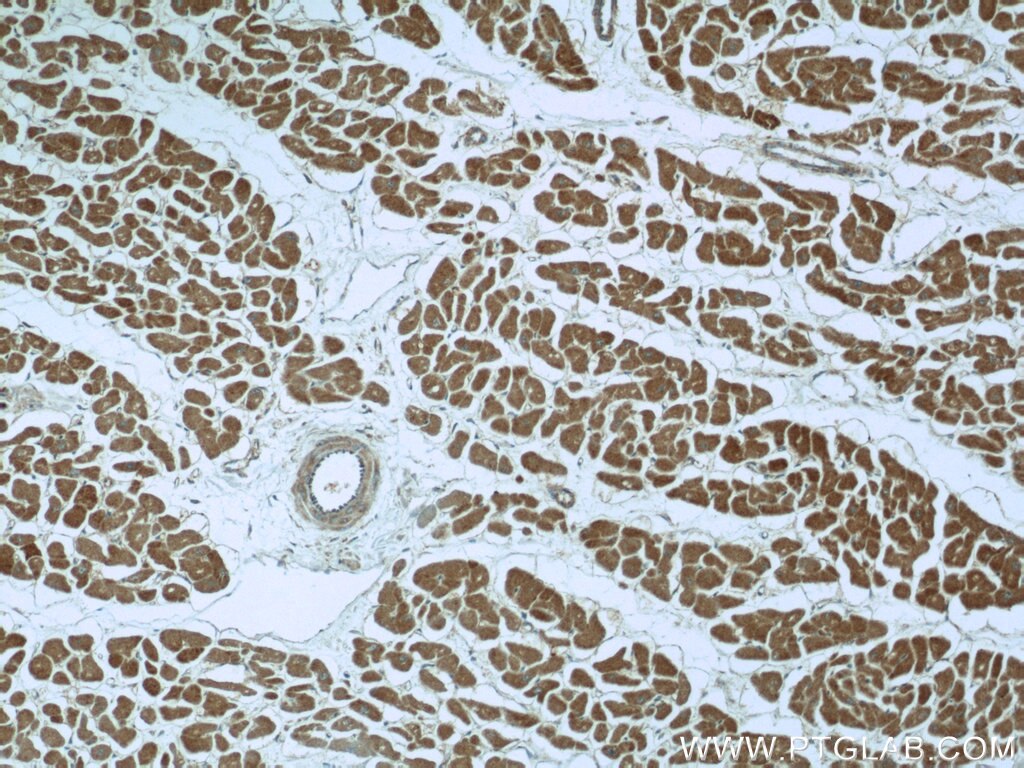 Immunohistochemistry (IHC) staining of human heart tissue using PDK3 Polyclonal antibody (12215-1-AP)