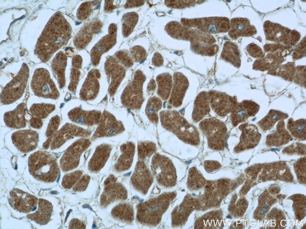 Immunohistochemistry (IHC) staining of human heart tissue using PDK3 Polyclonal antibody (12215-1-AP)
