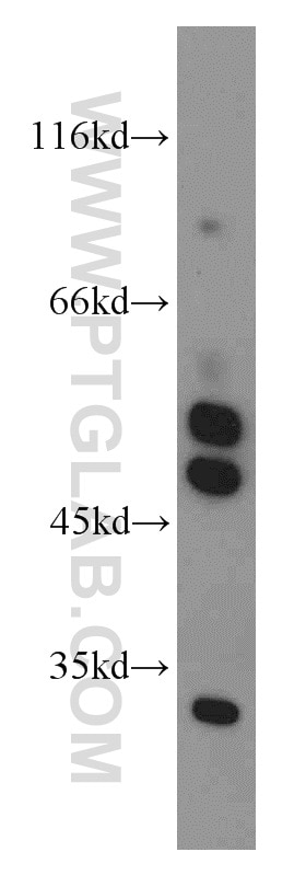 Western Blot (WB) analysis of mouse heart tissue using PDK3 Polyclonal antibody (12215-1-AP)