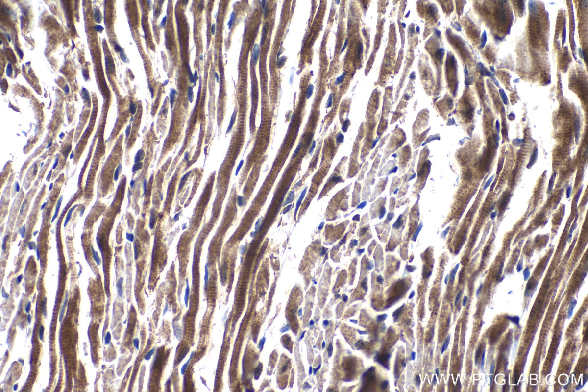 Immunohistochemistry (IHC) staining of mouse heart tissue using PDK4 Polyclonal antibody (12949-1-AP)