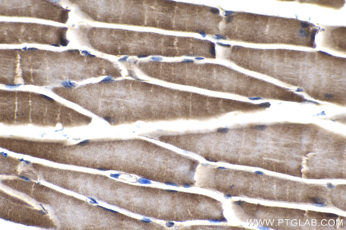 Immunohistochemistry (IHC) staining of mouse skeletal muscle tissue using PDK4 Polyclonal antibody (12949-1-AP)