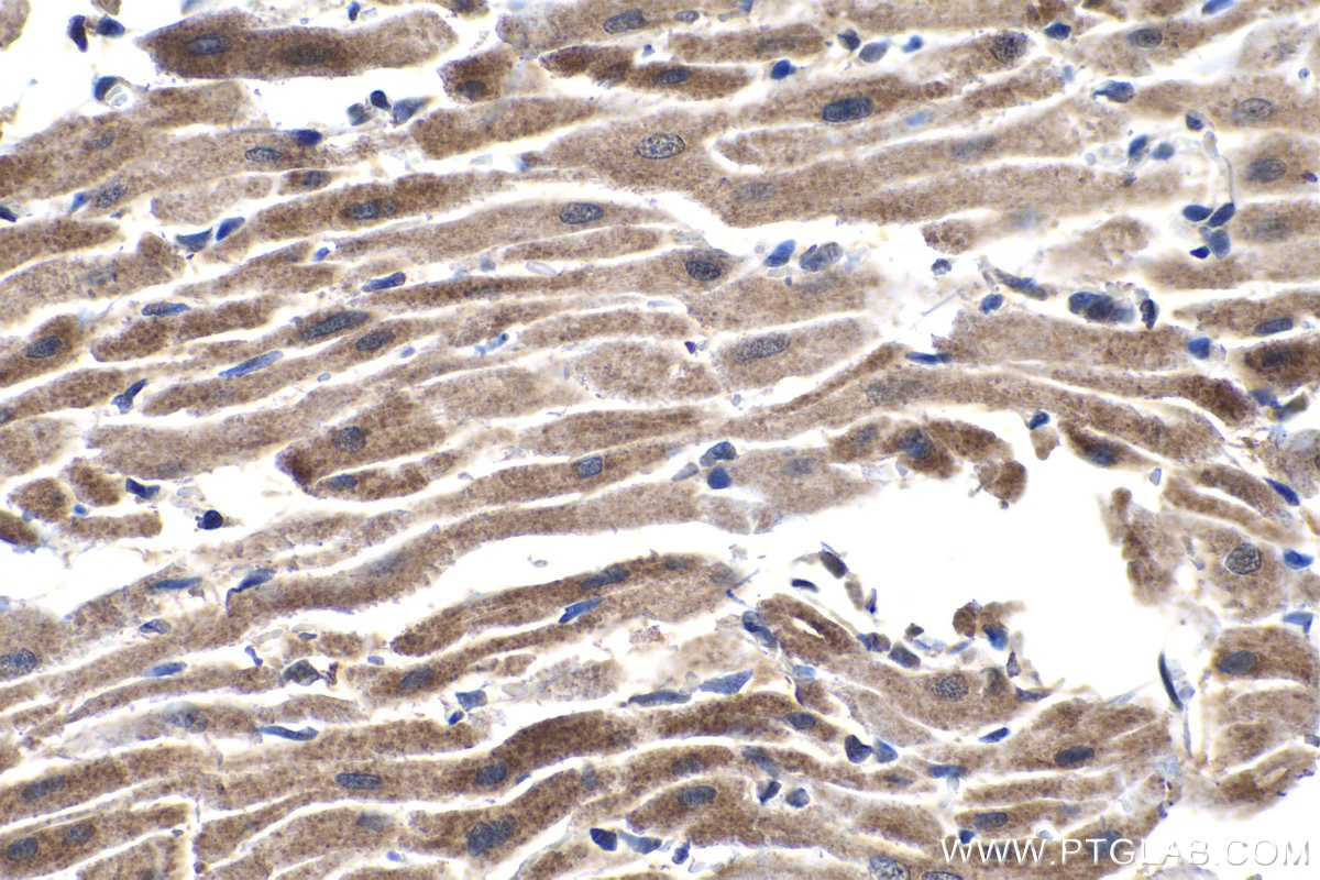 Immunohistochemistry (IHC) staining of rat heart tissue using PDK4 Polyclonal antibody (12949-1-AP)