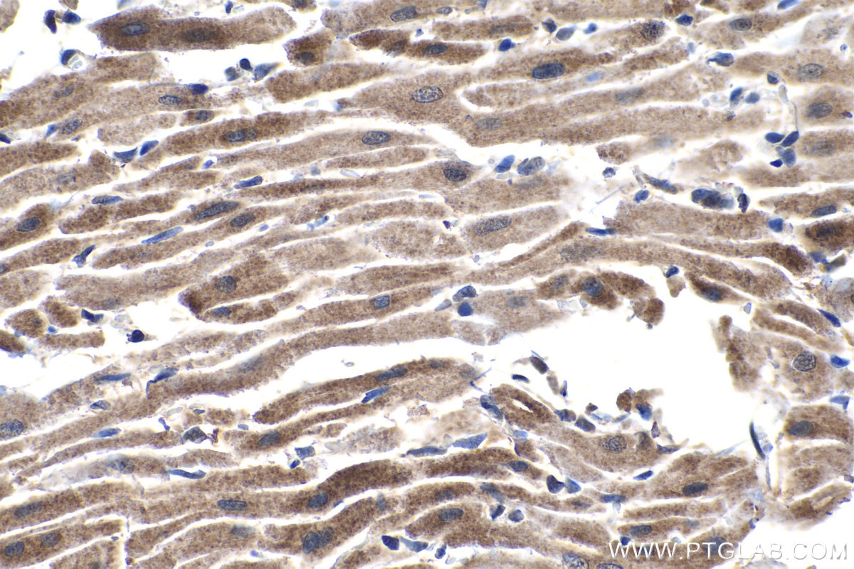 IHC staining of rat heart using 12949-1-AP