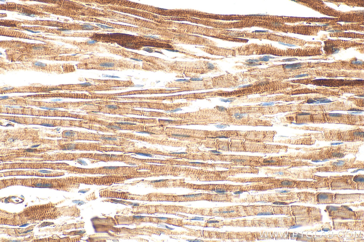 Immunohistochemistry (IHC) staining of mouse heart tissue using PDK4 Polyclonal antibody (12949-1-AP)