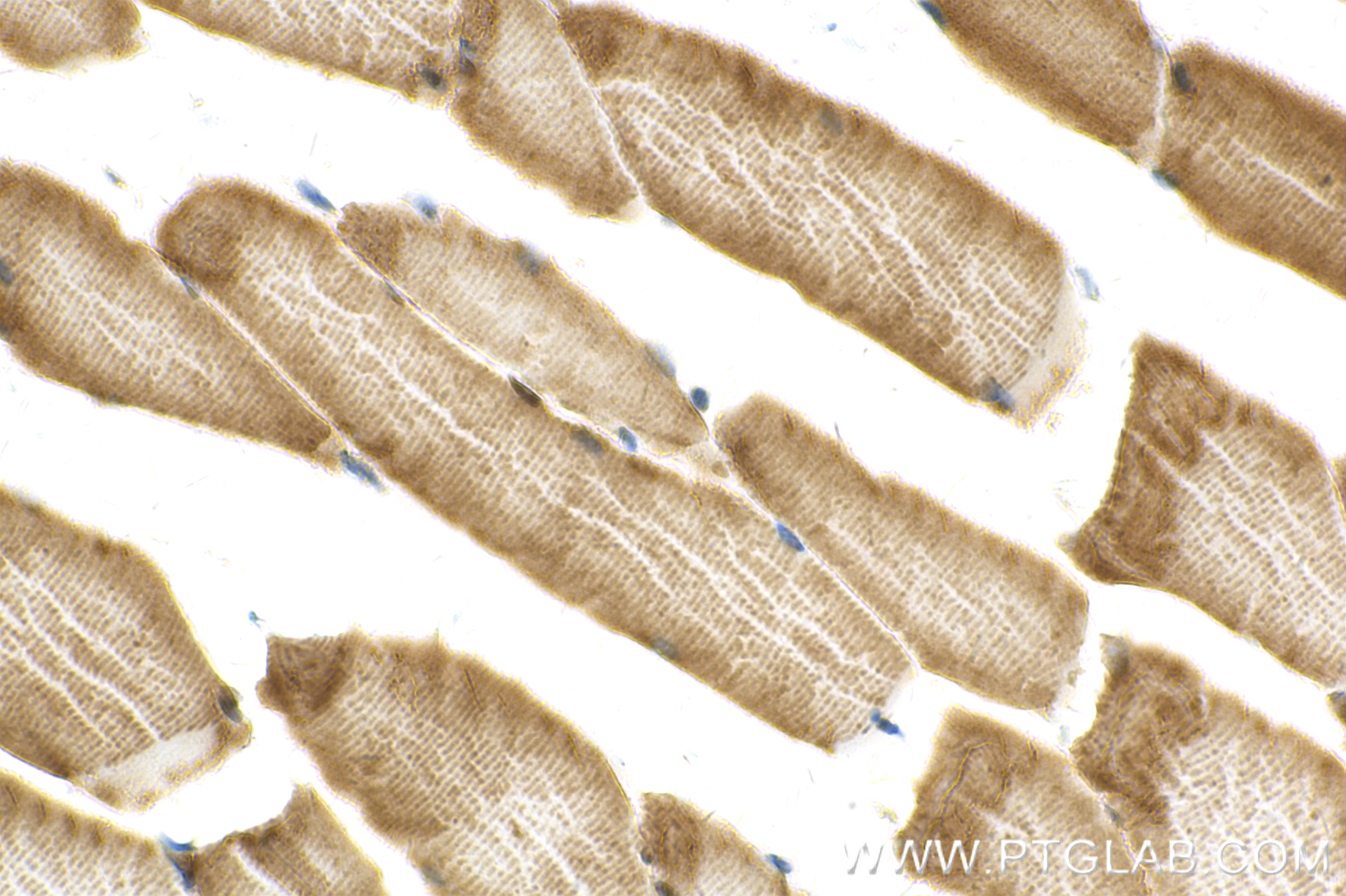 Immunohistochemistry (IHC) staining of mouse skeletal muscle tissue using PDK4 Recombinant antibody (83583-1-RR)